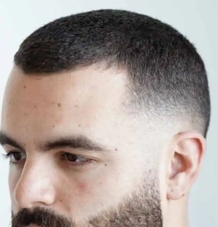 Temple Low Fade for Men with Receding Hairline